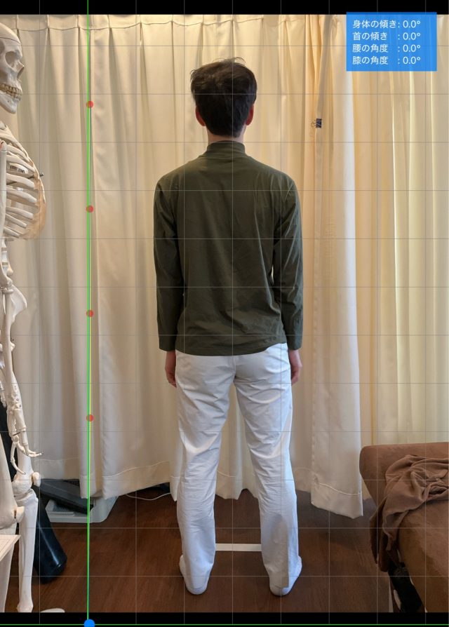 after画像