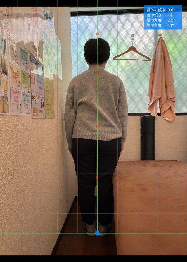 before画像