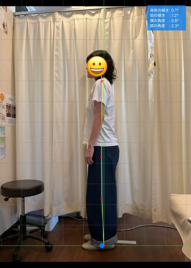 before画像