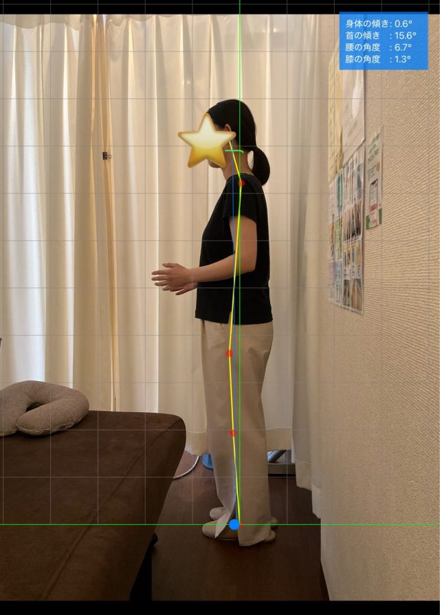 before画像