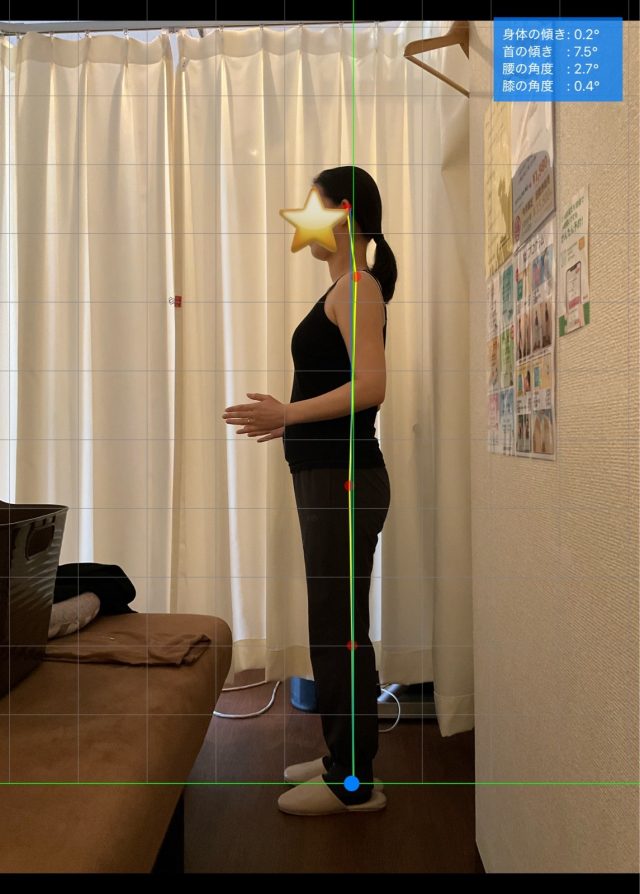 after画像
