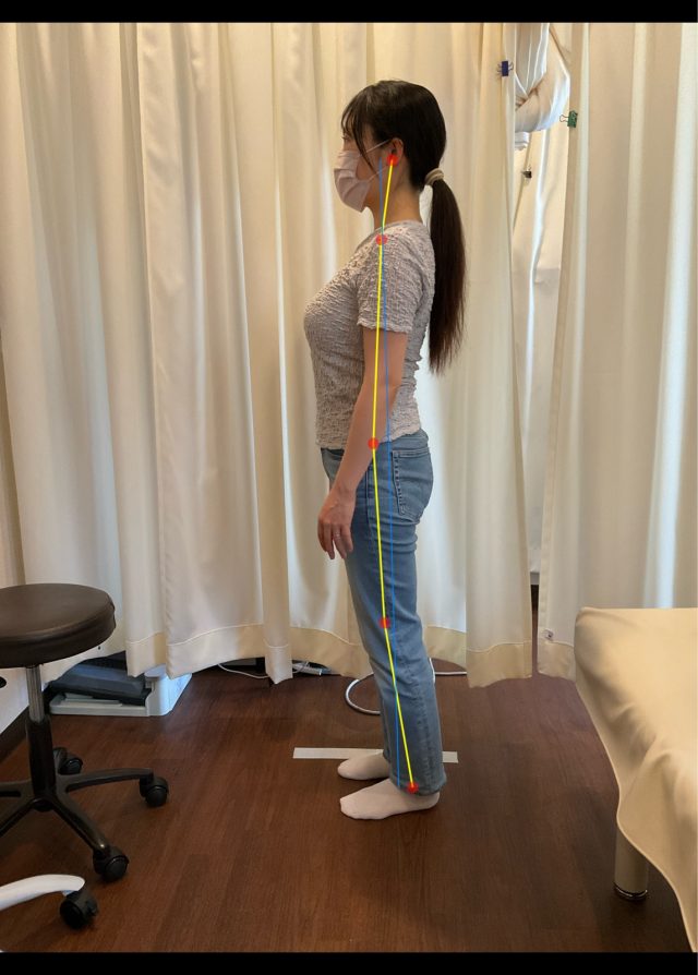 before画像