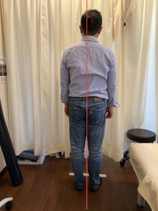 before画像