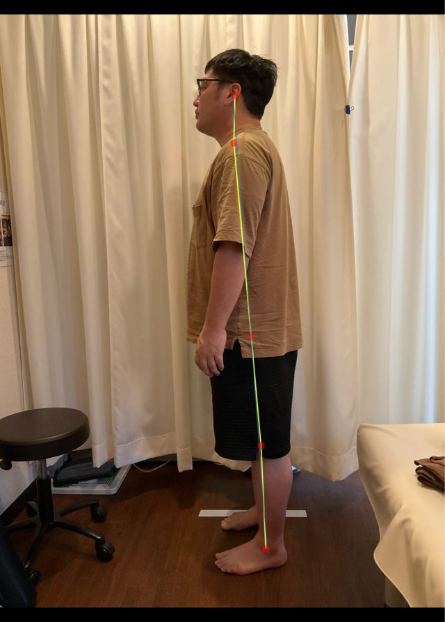 before画像