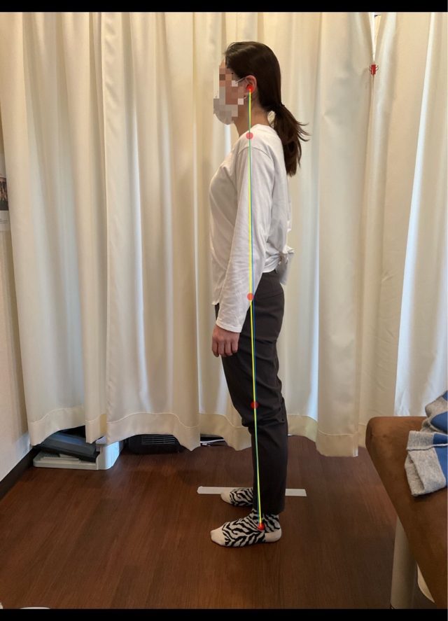 after画像