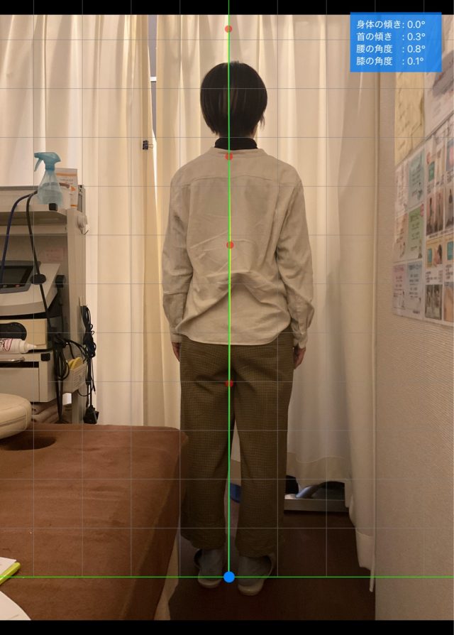 before画像