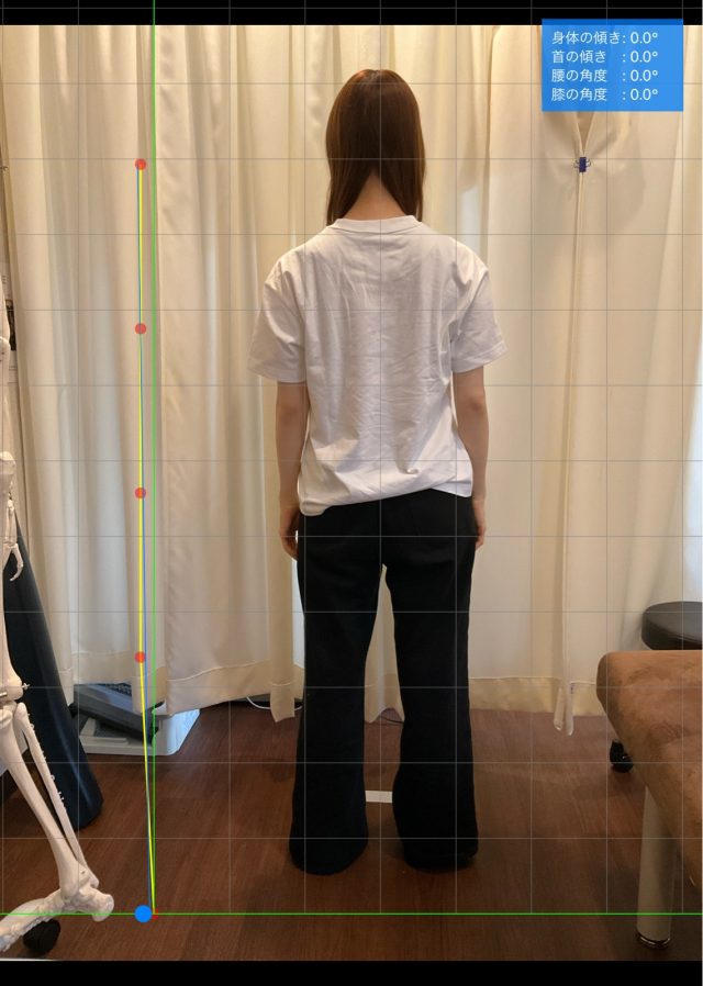 after画像