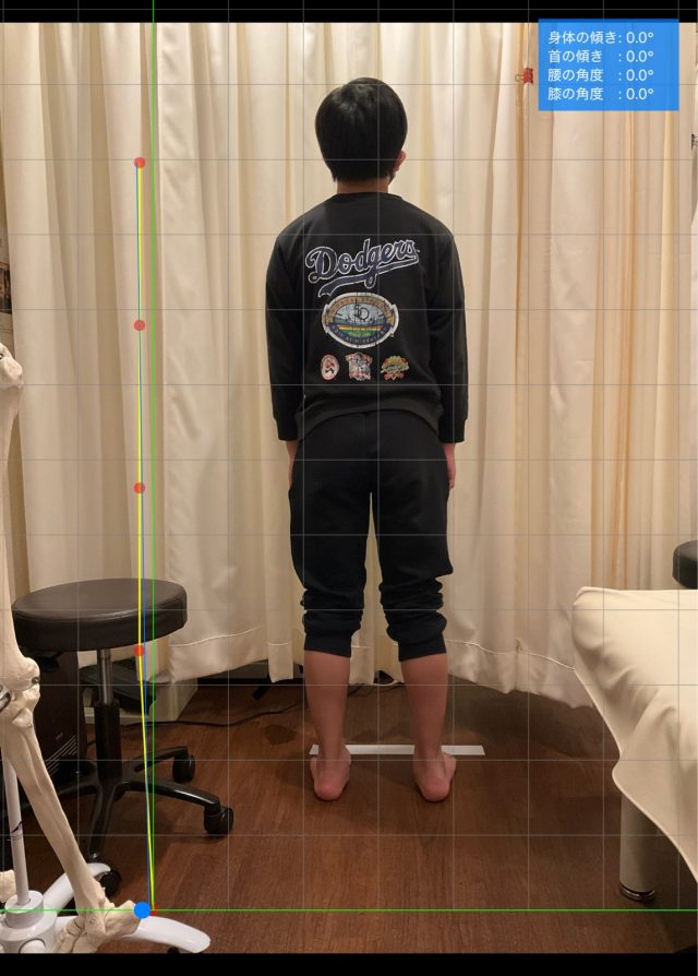 before画像
