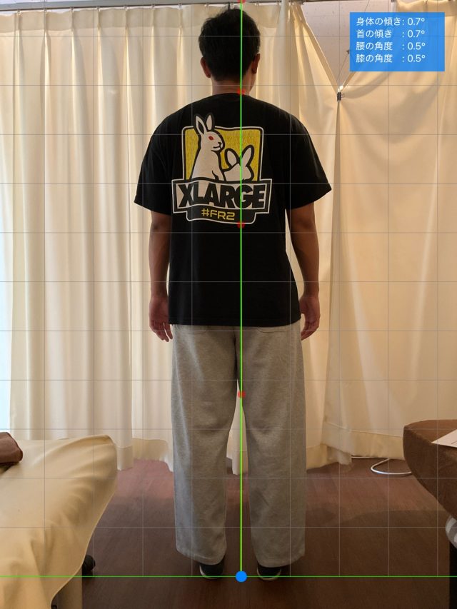 before画像