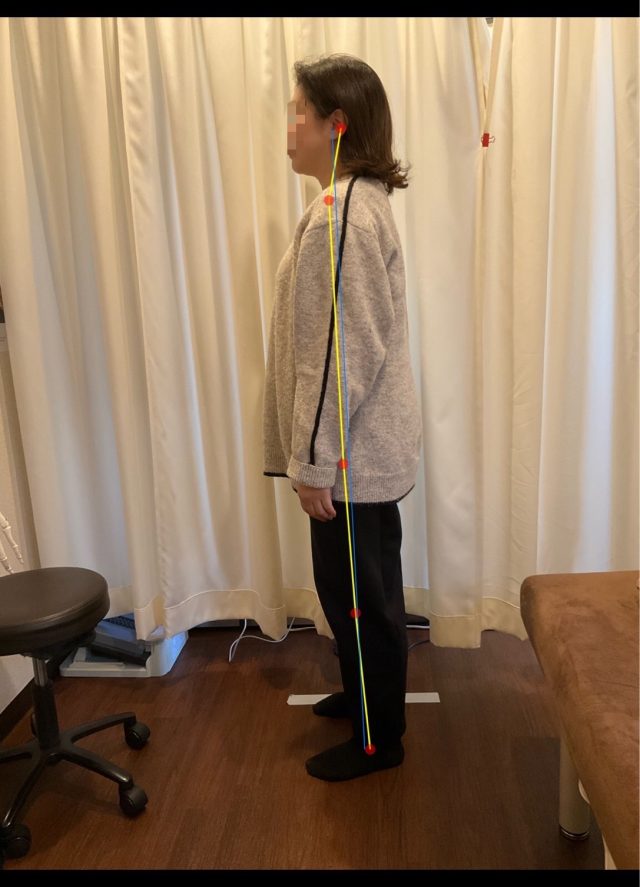 before画像